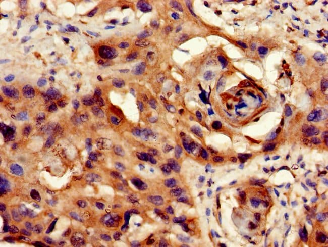 100UG PP1 BETA ANTIBODY 100 ug