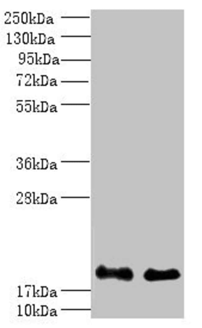 100UG CALCINEURIN B ANTIBODY 100 ug