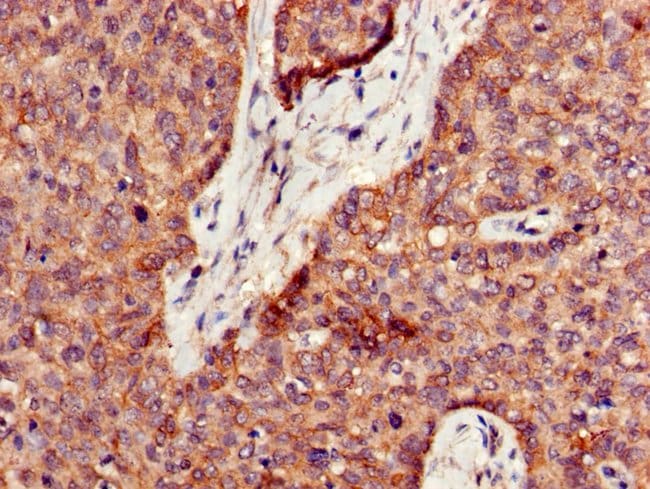 100UG PPT1 ANTIBODY 100 ug
