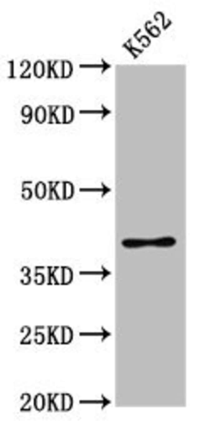 100UG PRB1 ANTIBODY 100 ug