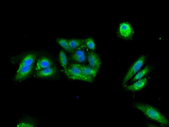 100UG PRKAR2A ANTIBODY 100 ug