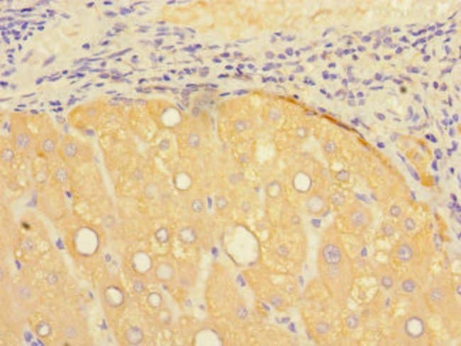 100UG PRESENILIN 1 ANTIBODY 100 ug
