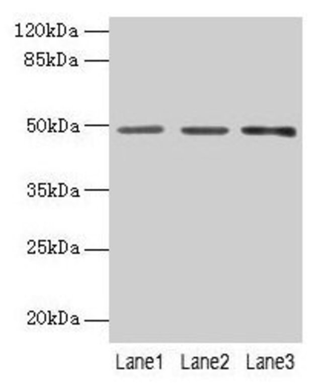 100UG PSG6 ANTIBODY 100 ug