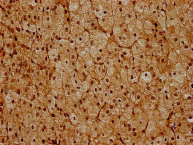 100UG PSMC6 ANTIBODY 100 ug