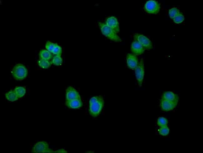 100UG PSMG1 ANTIBODY 100 ug