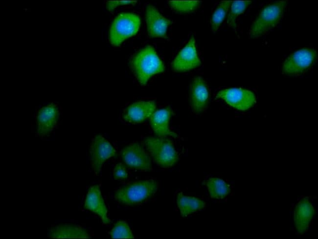 100UG PTGR2 ANTIBODY 100 ug
