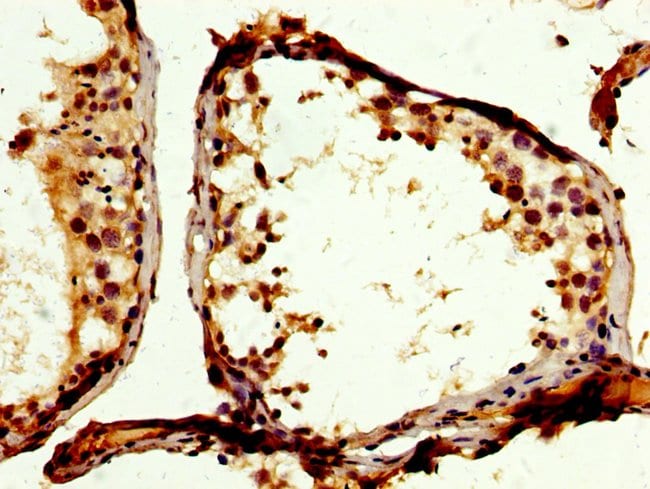 100UG PTPN12 ANTIBODY 100 ug