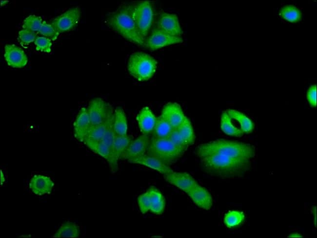 100UG PTX3 ANTIBODY 100 ug