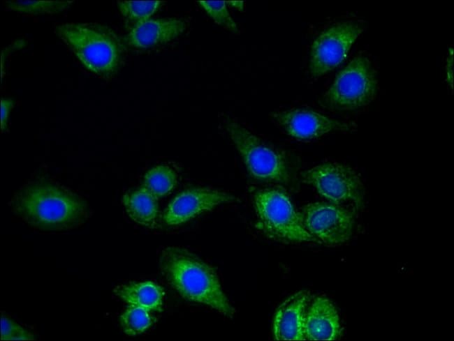 100UG QDPR ANTIBODY 100 ug