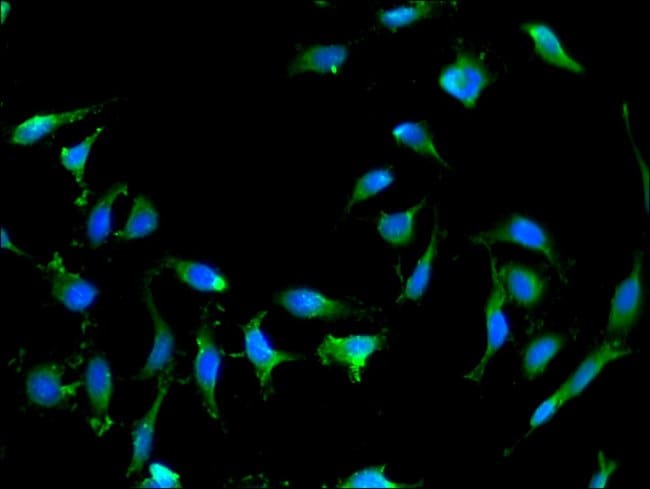 100UG RAB25 ANTIBODY 100 ug