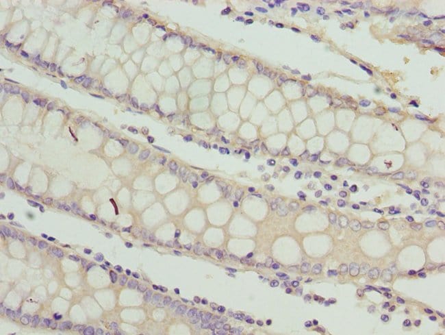100UG RAB3B ANTIBODY 100 ug