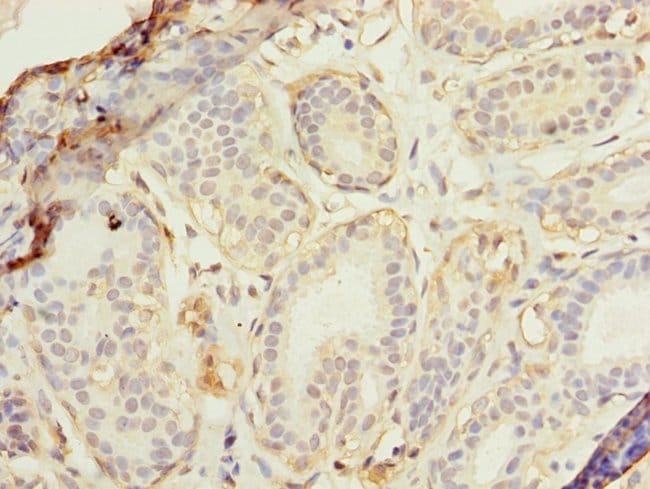 100UG RAD23B ANTIBODY 100 ug