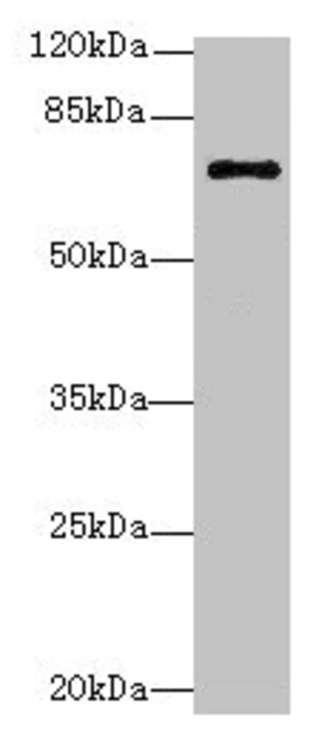 100UG RHOBTB3 ANTIBODY 100 ug