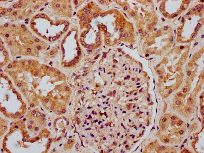 100UG RNASEH1 ANTIBODY 100 ug