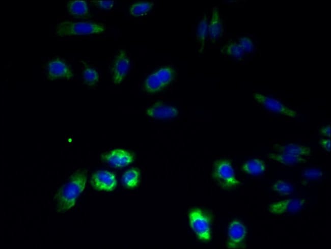 100UG RNF26 ANTIBODY 100 ug