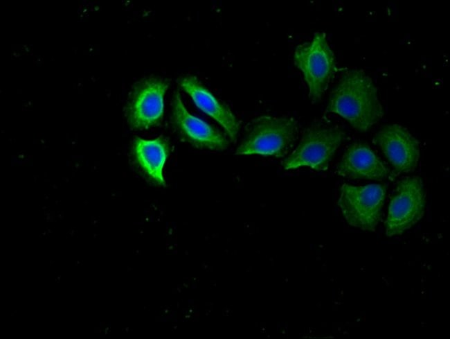 100UG RPS15 ANTIBODY 100 ug