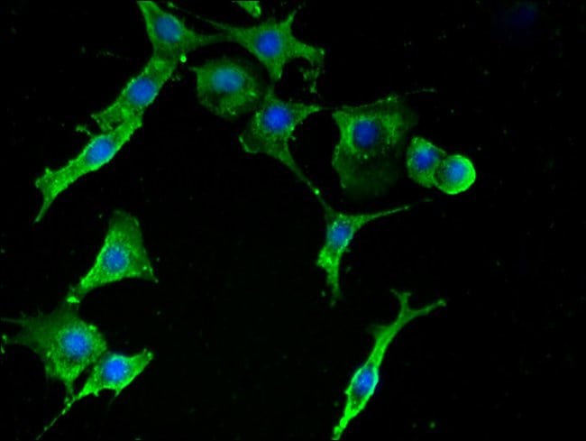100UG RPS2 ANTIBODY 100 ug