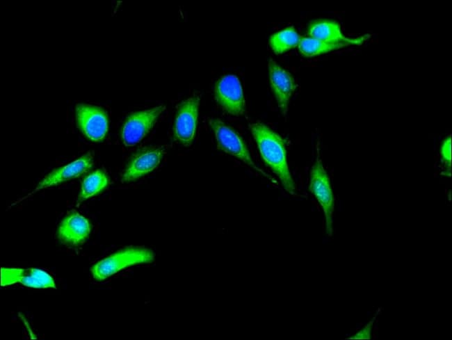 100UG MSK2 ANTIBODY 100 ug