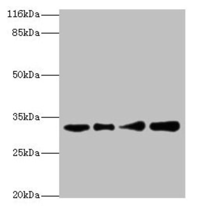 100UG RSU1 ANTIBODY 100 ug