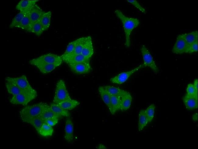 100UG SCNN1B ANTIBODY 100 ug