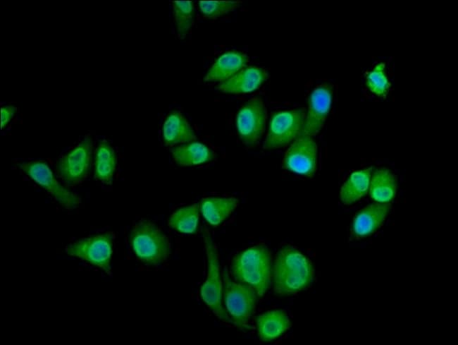 100UG SEC14L2 ANTIBODY 100 ug