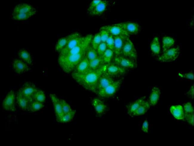 100UG SERPINA6 ANTIBODY 100 ug