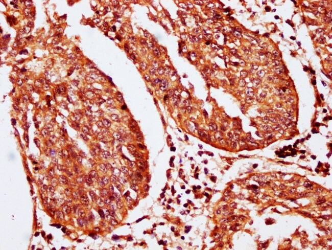 100UG SERPINB2 ANTIBODY 100 ug