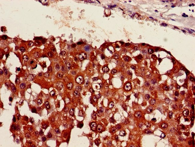 100UG SESN1 ANTIBODY 100 ug