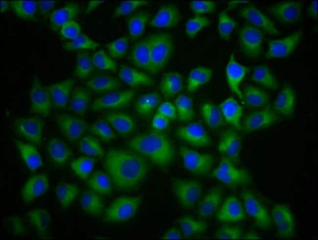 100UG HLA-G ANTIBODY 100 ug