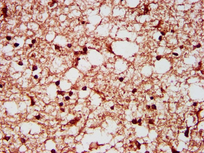 100UG SF3B1 ANTIBODY 100 ug