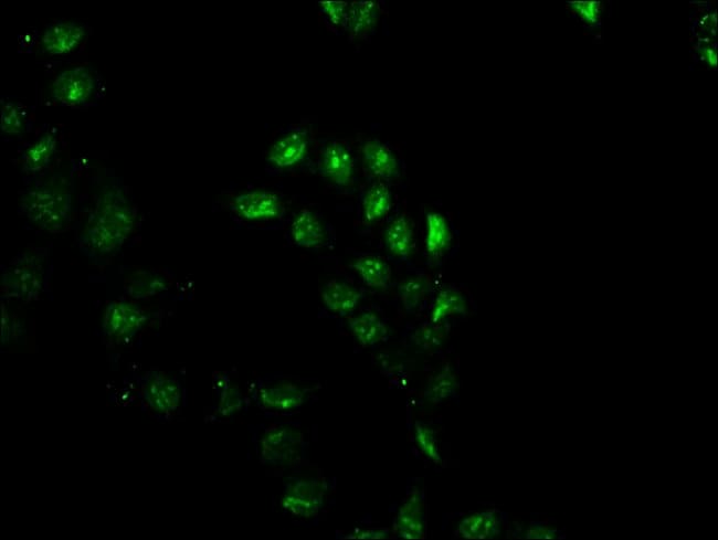 100UG GEMIN 2 ANTIBODY 100 ug
