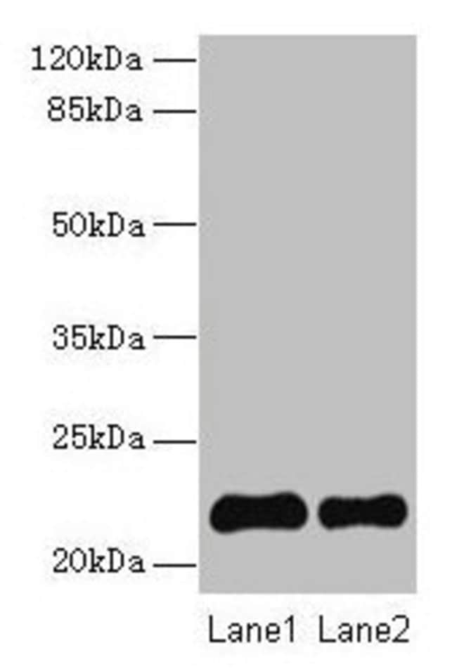 100UG SIRP DELTA ANTIBODY 100 ug