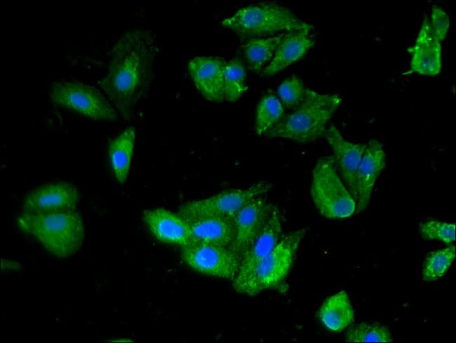 100UG SNON ANTIBODY 100 ug