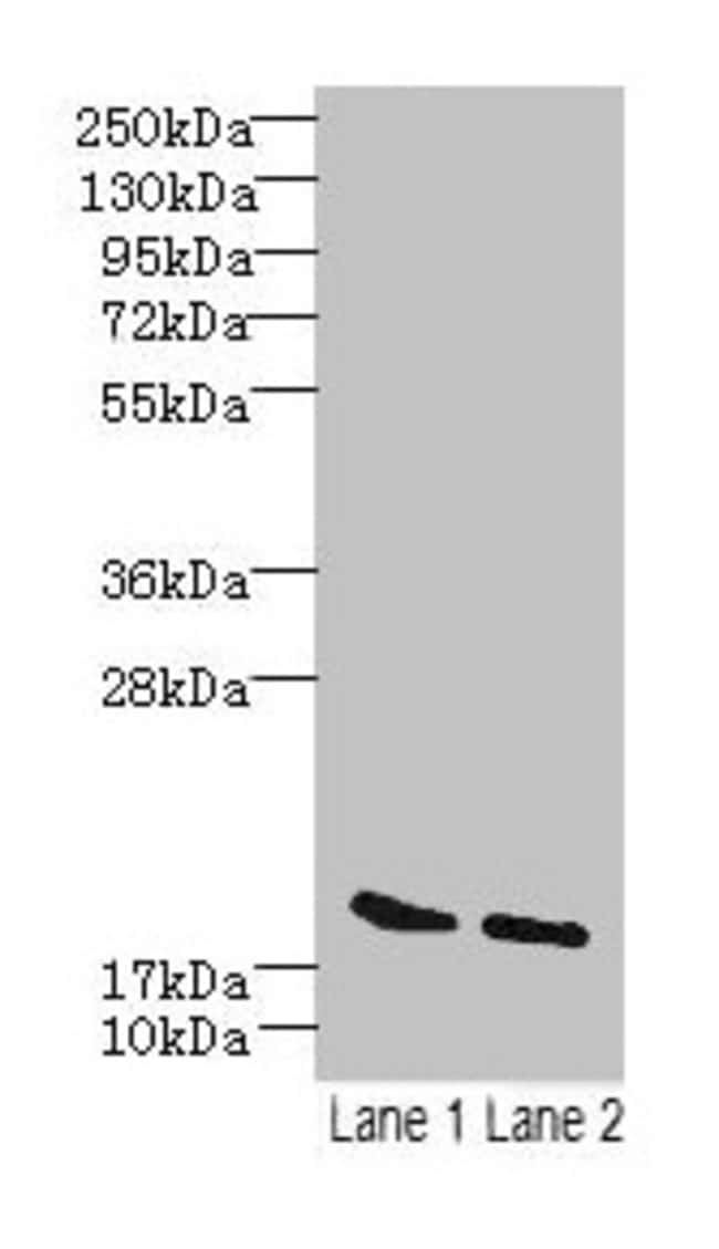100UG SKP1 ANTIBODY 100 ug