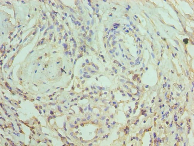 100UL CRACC ANTIBODY 100 ul