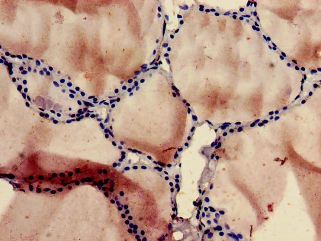 100UG P3 ANTIBODY 100 ug