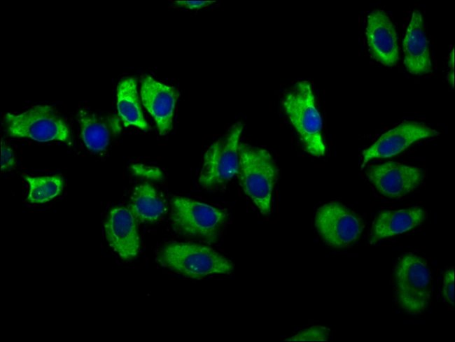 100UG NKCC1 ANTIBODY 100 ug