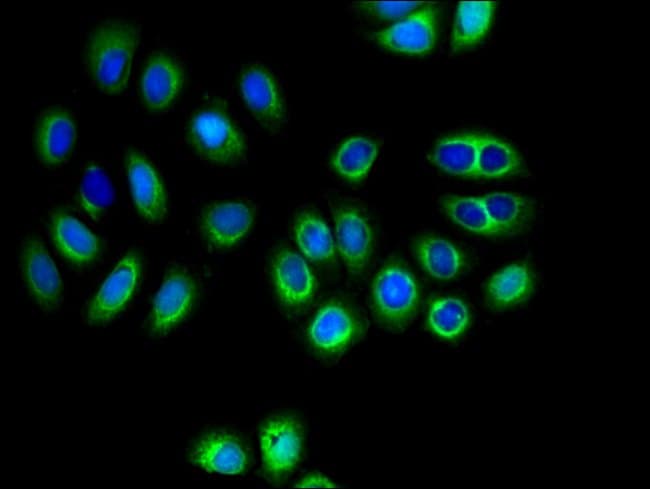 100UG SLC16A8 ANTIBODY 100 ug