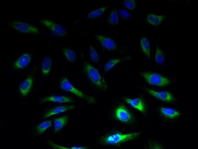 100UG SLC1A6 ANTIBODY 100 ug