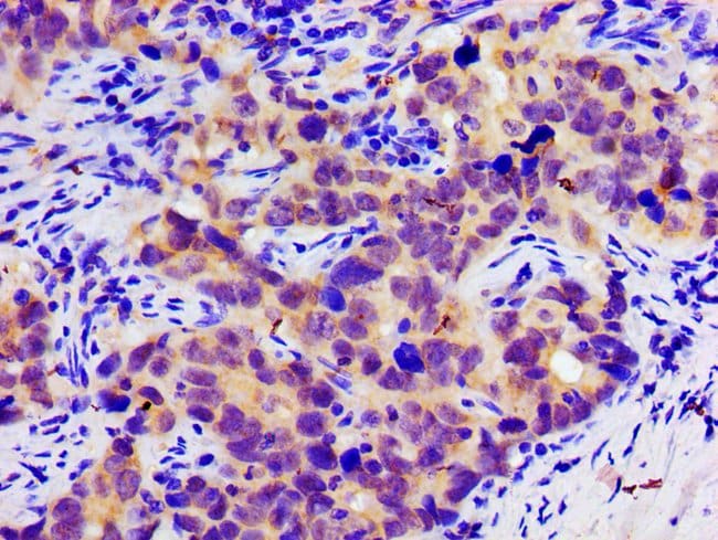 100UG SLC25A12 ANTIBODY 100 ug