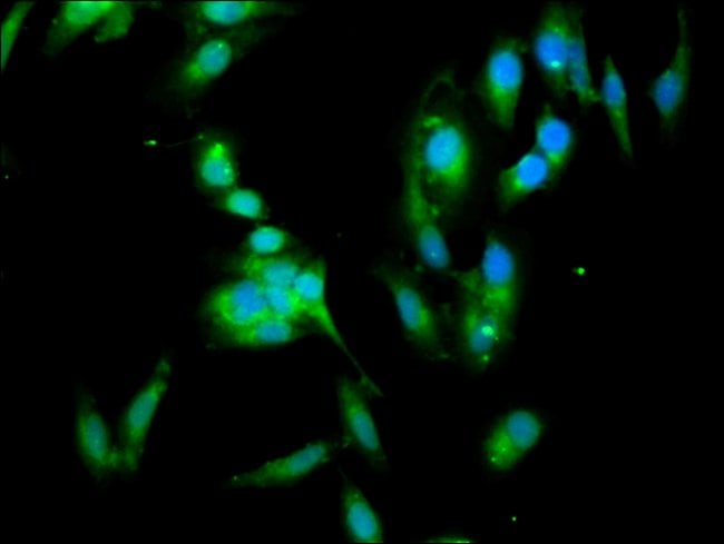 100UG 14-3-3 ETA ANTIBODY 100 ug