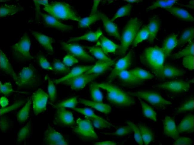 100UG SNRPE ANTIBODY 100 ug