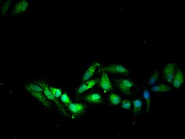 100UG SOCS7 ANTIBODY 100 ug