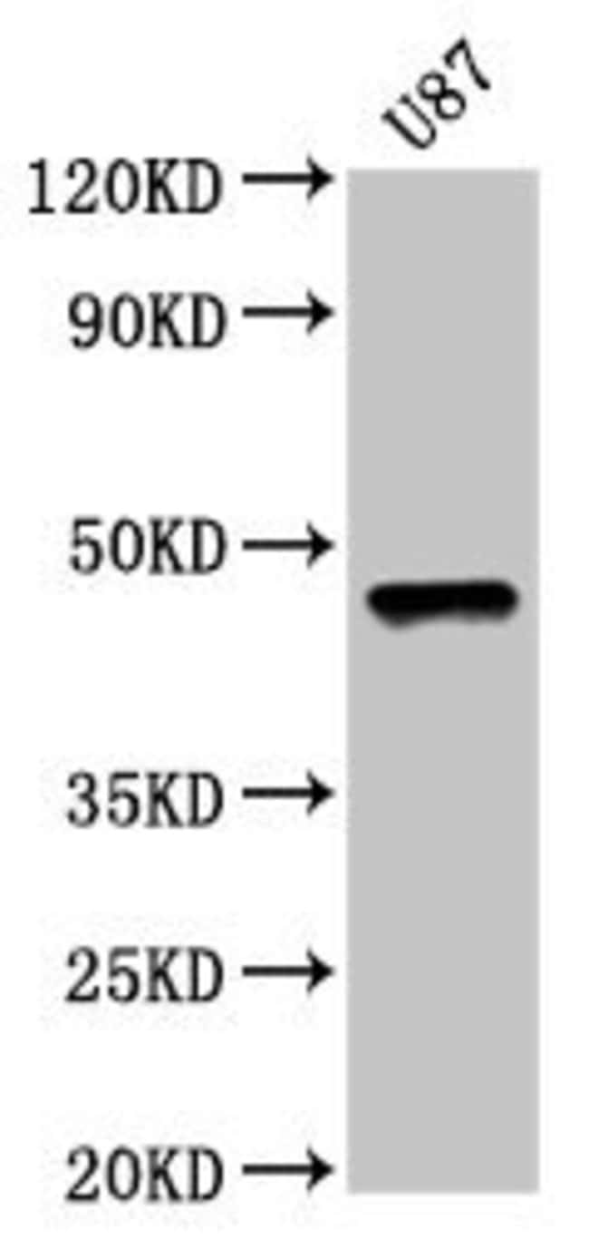 100UG SOX8 ANTIBODY 100 ug