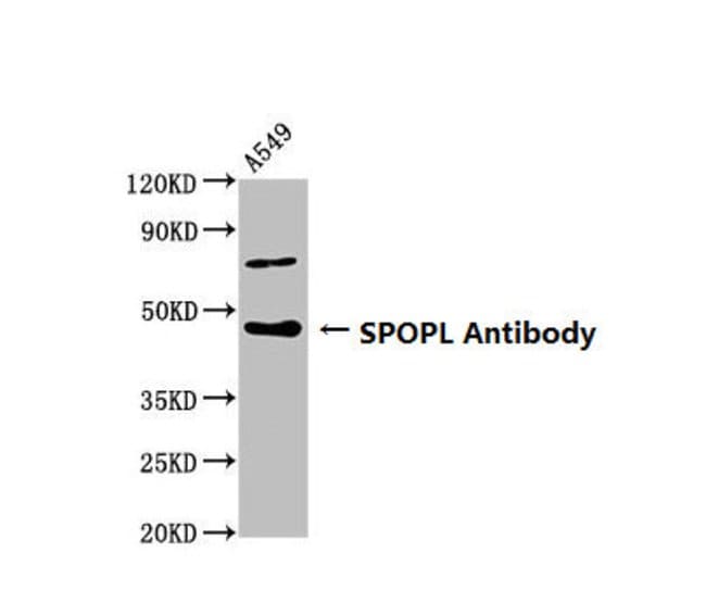 100UG SPOPL ANTIBODY 100 ug