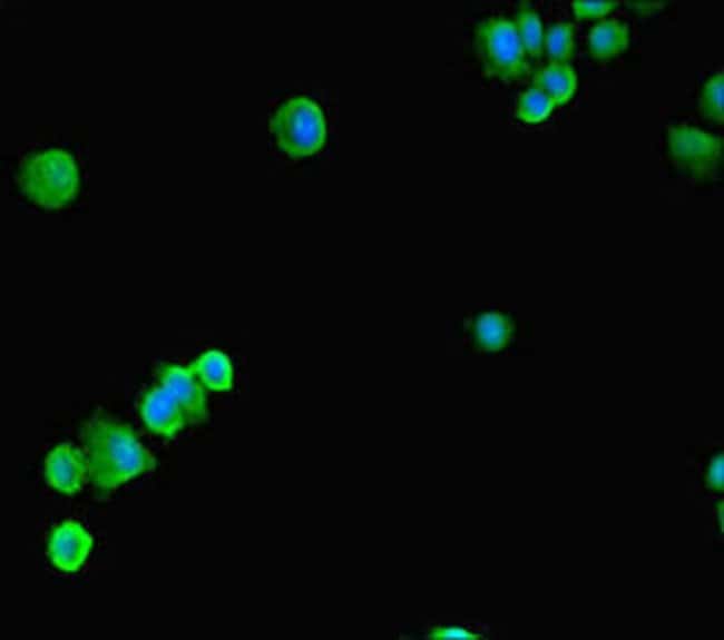 100UG SSRP1 ANTIBODY 100 ug