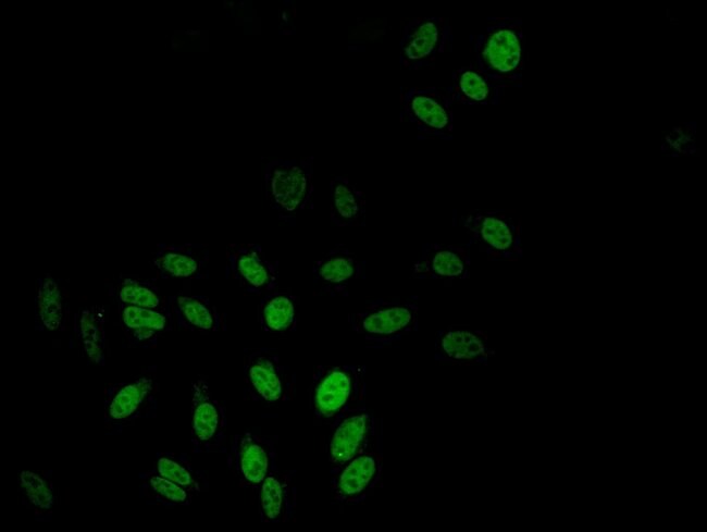 100UG TBL1X ANTIBODY 100 ug