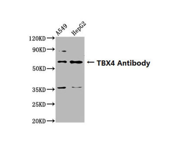 100UG TBX4 ANTIBODY 100 ug