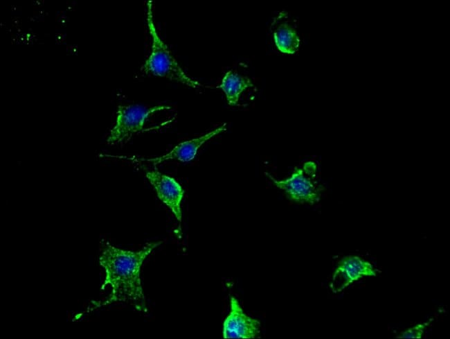 100UG TCN2 ANTIBODY 100 ug