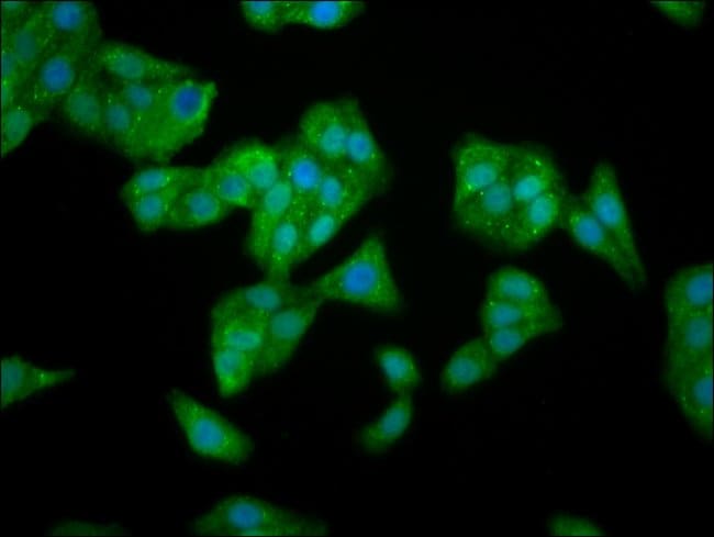 100UG TFB1M ANTIBODY 100 ug
